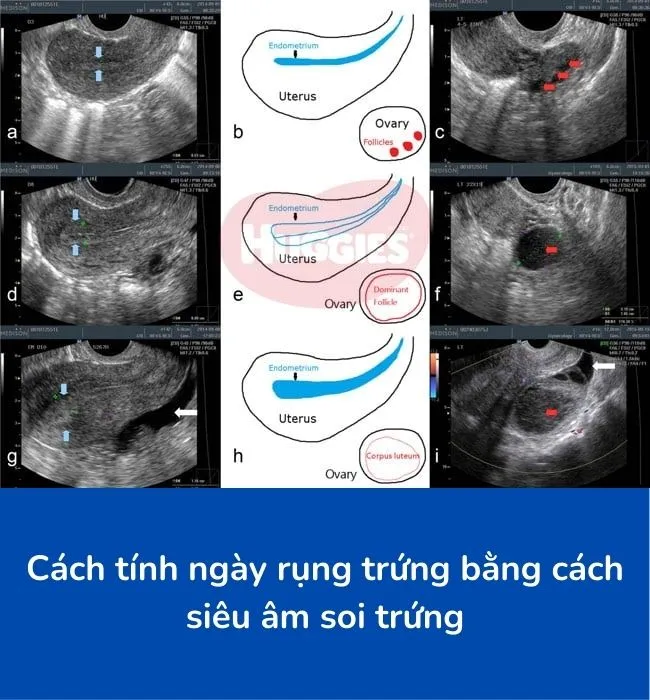Hình ảnh siêu âm soi trứng giúp bác sĩ theo dõi sự phát triển của nang noãn và xác định thời điểm rụng trứng chính xác