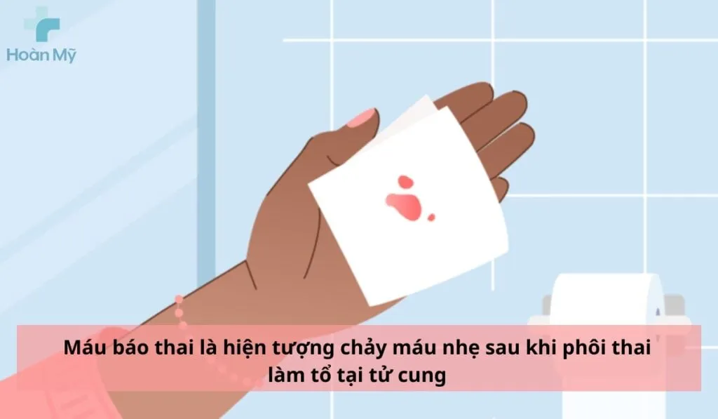 Hình ảnh minh họa máu báo thai xảy ra khi phôi thai làm tổ trong tử cung
