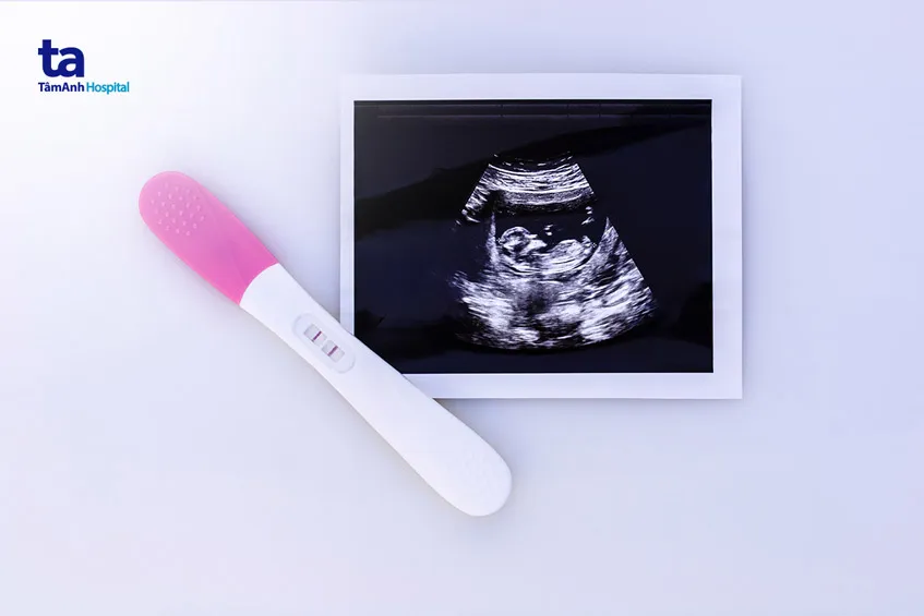 Siêu âm giúp xác định chính xác tình trạng thai nhi sau khi thử que 2 vạch