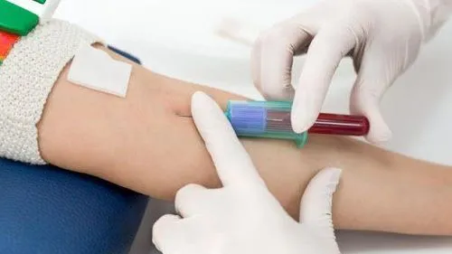 Hình ảnh lấy mẫu máu để xét nghiệm virus viêm gan B và theo dõi điều trị