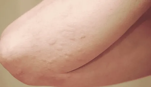 Bệnh nhân thông báo tình trạng sức khỏe cho bác sĩ khi kê đơn thuốc Scanneuron