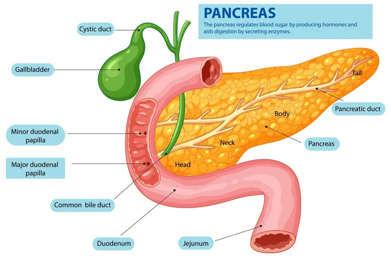 Hình ảnh minh họa hệ tiêu hóa và tuyến tụy bị viêm ảnh hưởng đến chức năng tiêu hóa