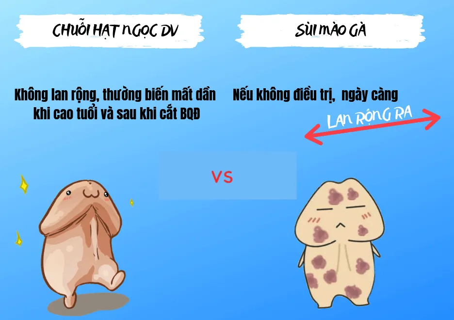 Phân biệt chuỗi hạt ngọc và sùi mào gà qua triệu chứng