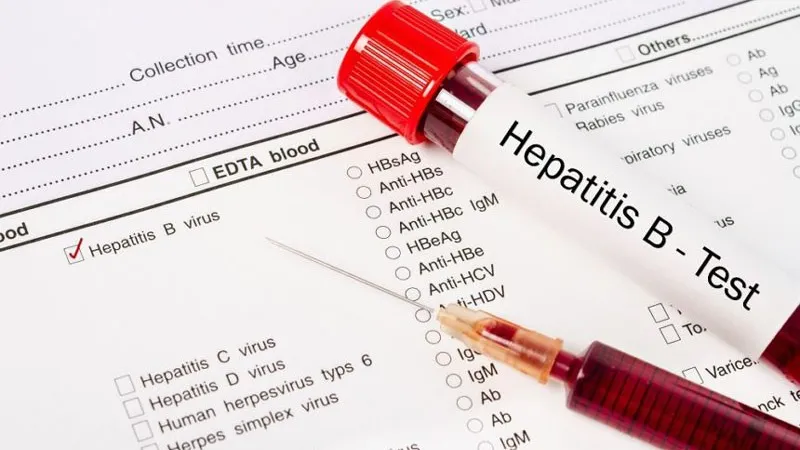 Nhân viên y tế đang xử lý mẫu xét nghiệm định lượng virus HBV-DNA trong phòng thí nghiệm