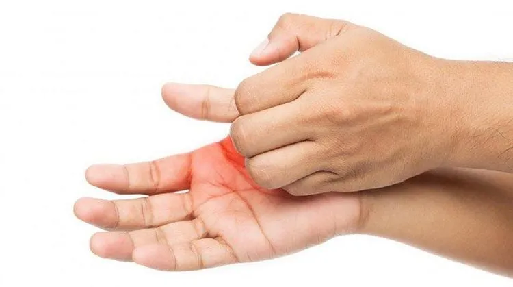 Mẹ bầu mang thai tuần 23 bị đau và ngứa ran ở bàn tay, triệu chứng thường gặp