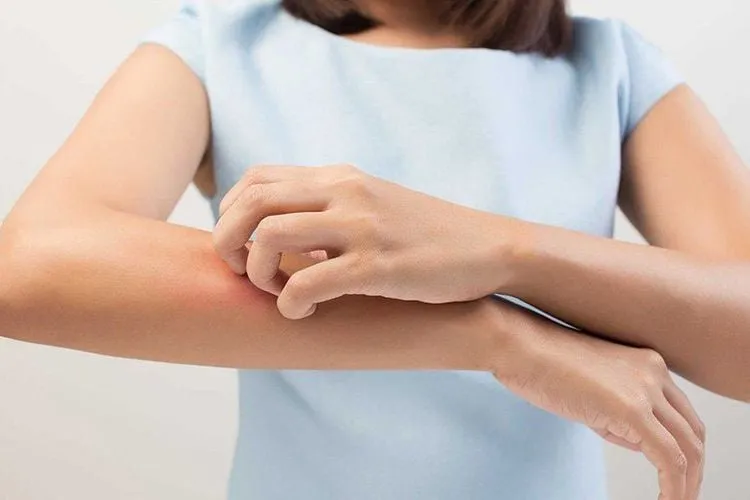 Nước tắm lá khế giúp giảm mẩn ngứa, dị ứng