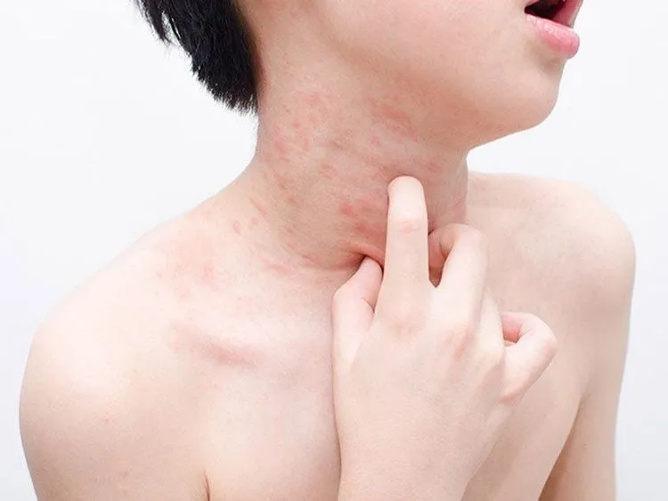Tác dụng phụ của Zopistad có thể gây ảnh hưởng đến sức khỏe