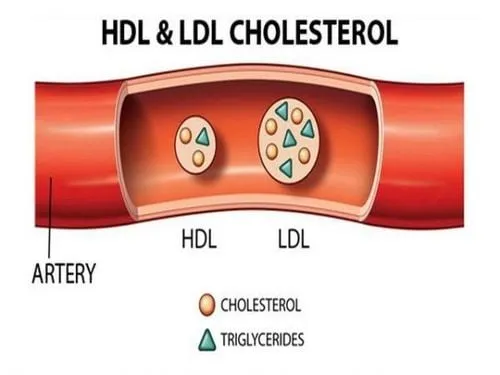 Biểu đồ minh họa thành phần và nồng độ cholesterol toàn phần bao gồm LDL và HDL trong máu