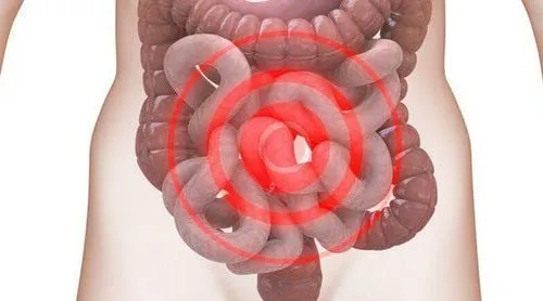 Hình ảnh minh họa đường ruột, liên quan đến Hội chứng ruột kích thích (IBS) - một nguyên nhân gây đau bụng dưới ở phụ nữ.