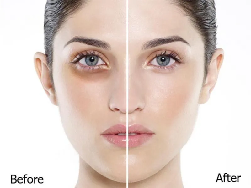 Hỗn hợp Vaseline và viên nang Vitamin E
