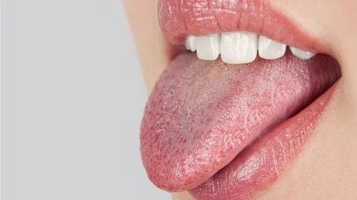 Hình ảnh minh họa tác dụng phụ khô miệng