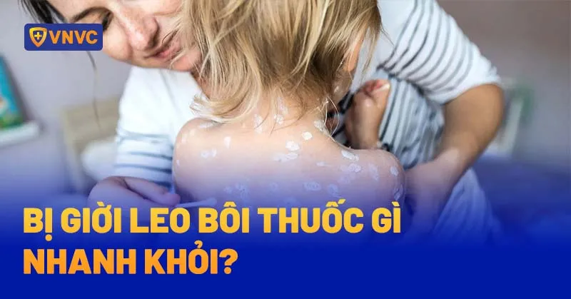 Hình ảnh minh họa bệnh giời leo và thuốc bôi